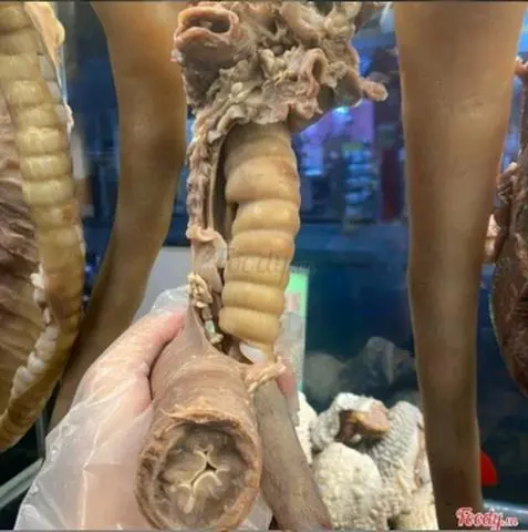 Hình ảnh Cuống họng