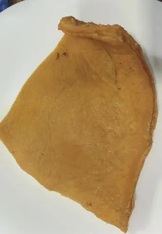 Hình ảnh Bao tử không
