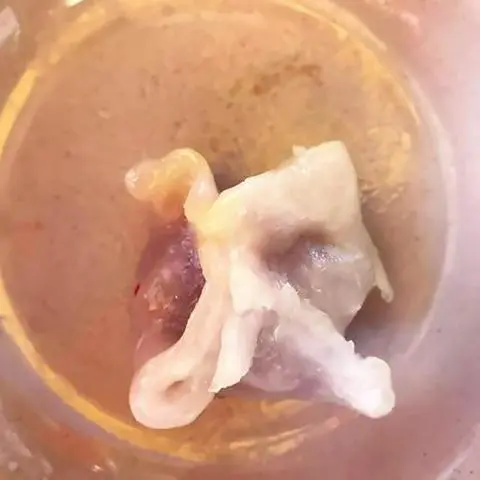 Hình ảnh Há cảo mực